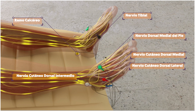 Aplicación Nesa Neuromodulación No Invasiva en tobillos