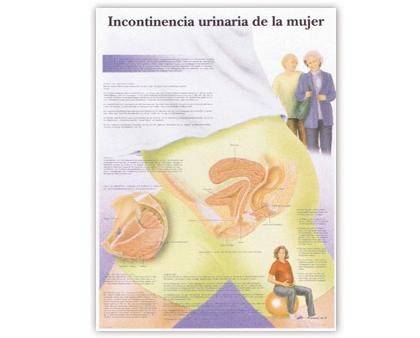Incontinencia Urinaria - Lámina Anatomía