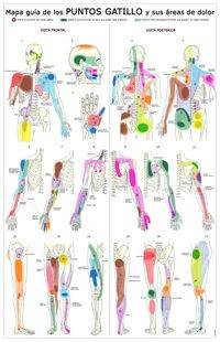Puntos Gatillo - Lámina Anatomía