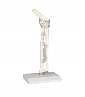 Articulación del codo con ligamentos - Modelo Anatómico